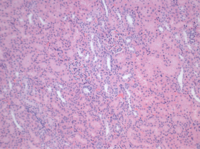 Histology slide, kidney tissue, microscopic image, cellular structure, educational, biological study.