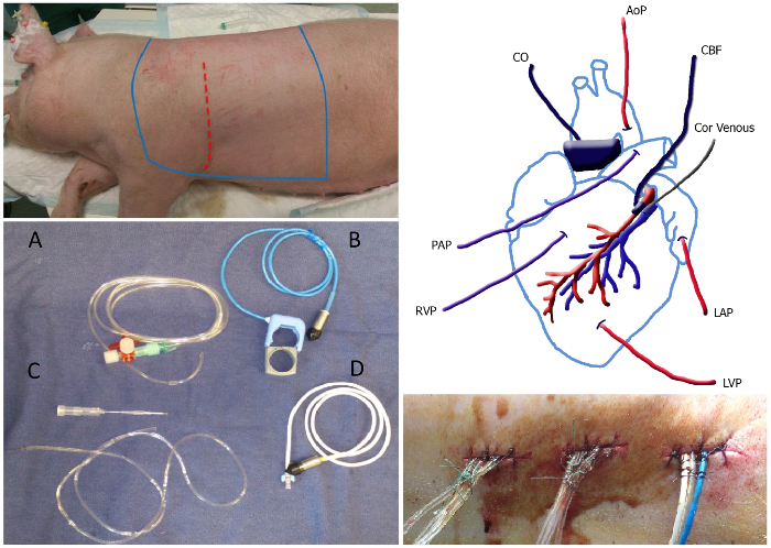 figure-protocol-1 Porcine cardiovascular study; catheter equipment; anatomical diagram; incisions with vascular access.