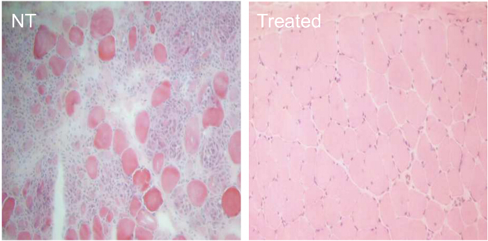 figure-results-11 Histology diagram; muscle tissue comparison, NT vs. treated, analyzing cell structure changes.
