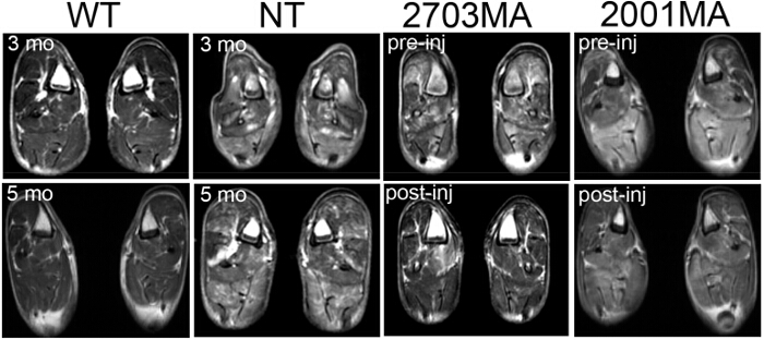 figure-results-4 MRI brain scans compare WT, NT, 2703MA, 2001MA at varying stages. Pre- and post-injection shown.