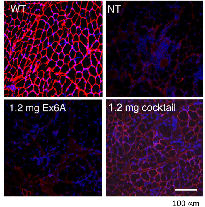 figure-results-9 Fluorescence microscopy diagram; cellular protein expression comparison across four treatments.
