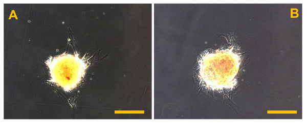 figure-results-12 Cell growth comparison under microscope; experiment showing structural differences in samples A and B.