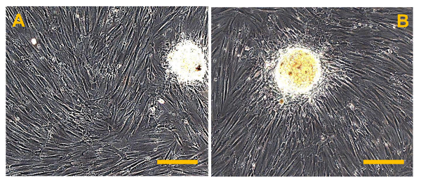 figure-results-13 Stem cell culture microscopy images; A: Unstimulated; B: Differentiation initiation.