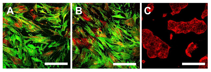 figure-results-14 Fluorescence microscopy images showing cell morphology; green actin filaments, red nuclei in fibroblasts.