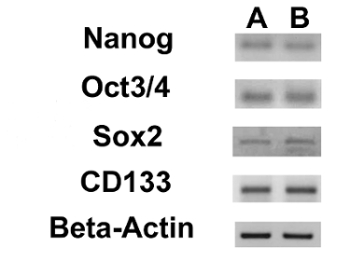 figure-results-17 Western blot analysis showing protein levels: Nanog, Oct3/4, Sox2, CD133, Beta-Actin.