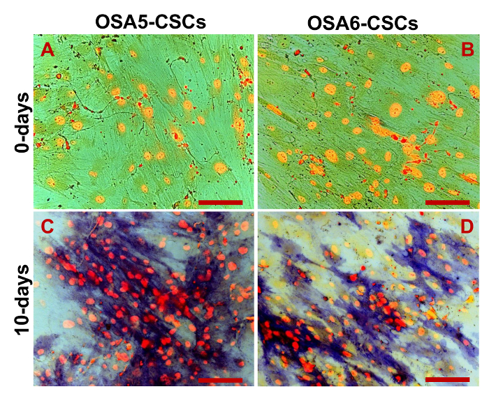 figure-results-18 OSA5, OSA6-CSCs differentiation process, microscopy images, 0-10 days, cellular changes analysis.