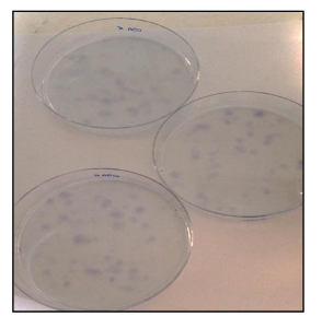 figure-results-21 Bacterial colony growth on agar plates; microbiology experiment; culture analysis; petri dishes.