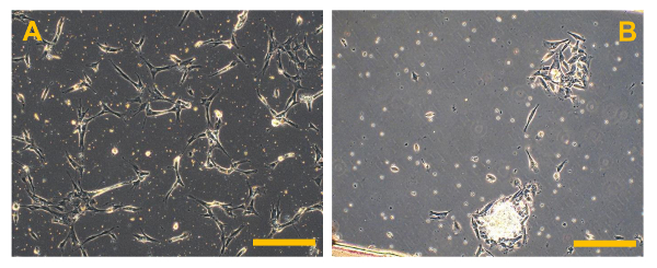 figure-results-5 Cell culture comparison; microscope image; left: dense cell growth, right: cell detachment.