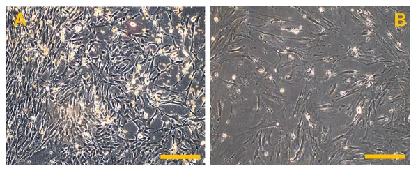 figure-results-6 Cell culture comparison; microscopy images of fibroblasts, high density vs. low density analysis.