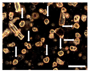 figure-results-8 Crystal formation under microscope; magnified image with arrows indicating formations.