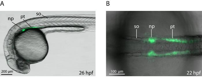 figure-results-3 Zebrafish embryo development, fluorescence microscopy; neural structures labeled at 26 and 22 hpf.