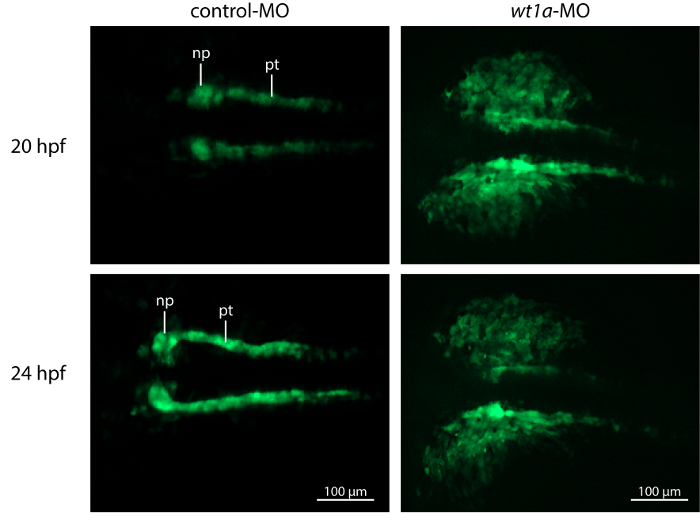 figure-results-4 Fluorescence microscopy of control and wt1a-MO embryos at 20hpf and 24hpf showing nephron structures.