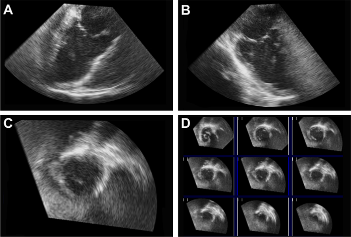 Ultrasound tomograph images in dynamic tissue analysis; diagnostic imaging results, multislice data.