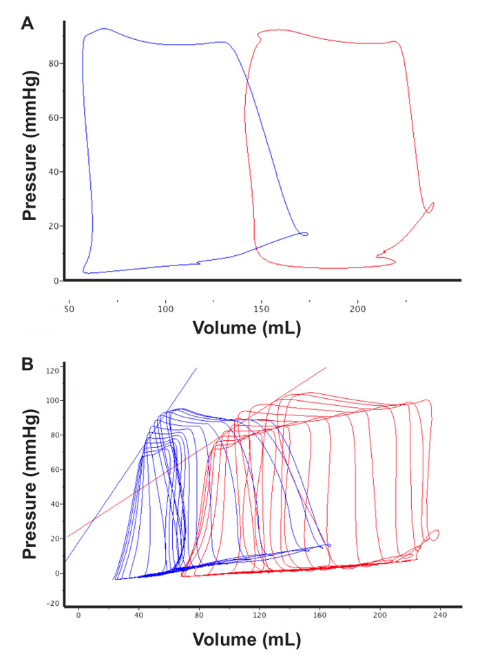Cardiac pressure-volume loops; graph showing systolic-diastolic cycle; hemodynamic analysis.
