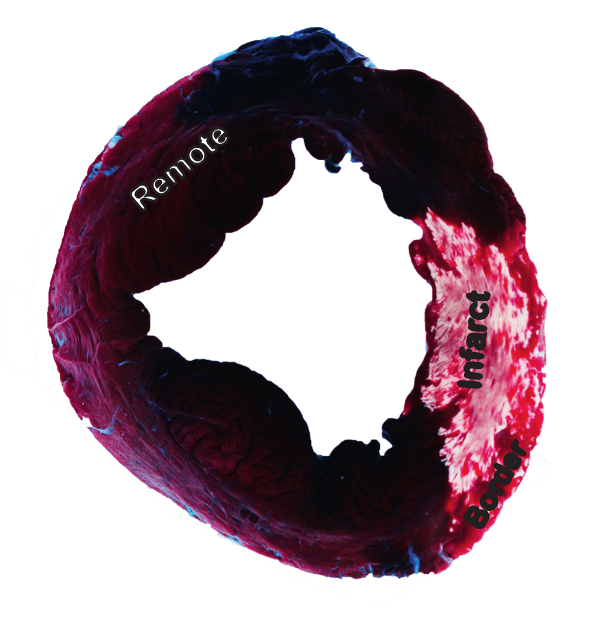 Heart tissue cross-section, colorimetric analysis, highlighting remote, infarct, and border zones.