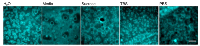 Microscopy image of cells in different solutions: H2O, media, sucrose, TBS, PBS; cell observation.