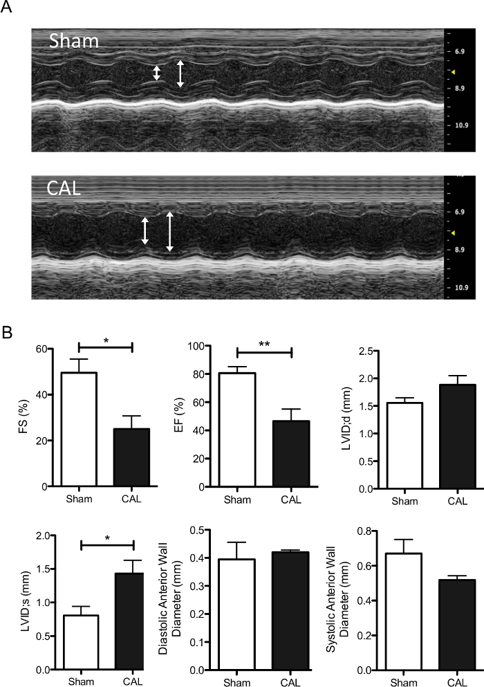 Myocardial Infarction in Neonatal Mice, A Model of Cardiac Regeneration ...