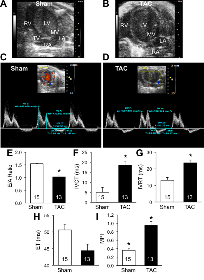 figure-results-6 Cardiac function analysis, ultrasound and Doppler images with E/A ratio, IVCT, IVRT, ET, MPI charts.