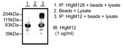 Western blot result; protein bands, immunoblotting, molecular weight markers, protein isolation analysis.