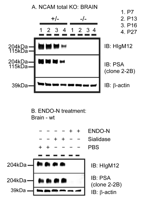NCAM knockout brain Western blot; protein expression analysis; ENDO-N treatment comparison; IB: HIgM12, PSA, β-actin.