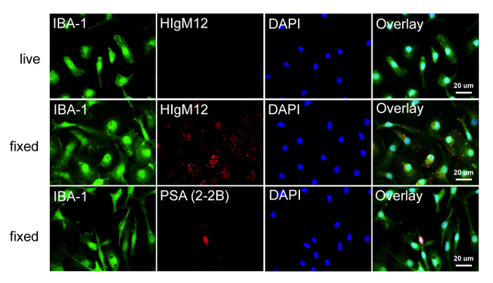 Immunofluorescence microscopy of live and fixed cells, showing IBA-1, HlgM12, DAPI staining.