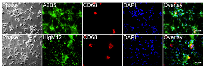 Fluorescence microscopy panel; cell staining with A2B5, HIgM12, CD68 markers, and DAPI overlay.