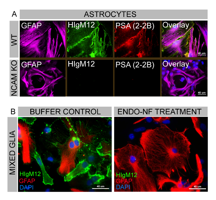 Astrocyte fluorescence microscopy, GFAP, HlgM12, PSA staining; NCAM KO effect, endo-NF treatment study.