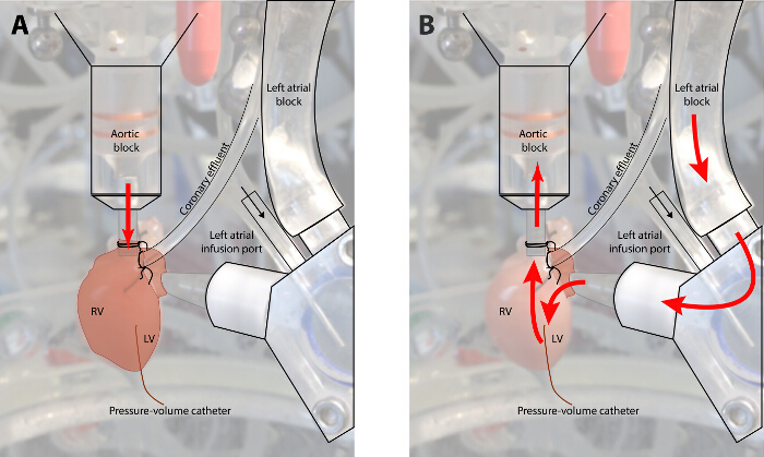 Cardiac blood flow diagram illustrating pressure and volume measurement setup with catheters.