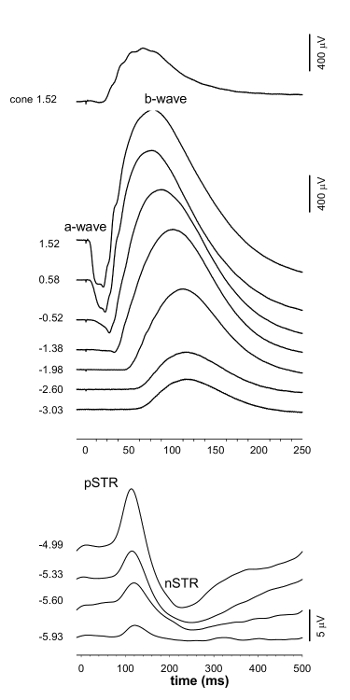 figure-results-1 Electroretinography graph; a-wave, b-wave analysis; amplitude response vs. time; visual studies.