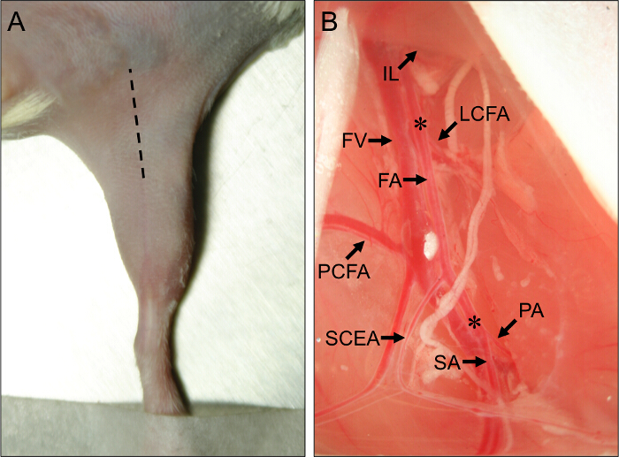 Microvascular dissection, labeled anatomical diagram of blood vessels in lab tissue specimen.