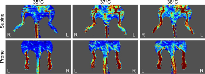 Infrared thermal imaging, supine and prone; temperature variance at 35°C, 37°C, 38°C; analysis.