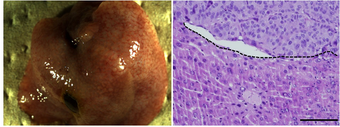 Liver tissue comparison; left: gross anatomy, right: histological section, cellular architecture.