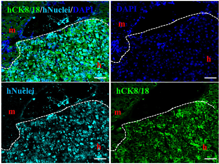 Immunofluorescence microscopy comparing hCK8/18, hNuclei, and DAPI staining in tissues.