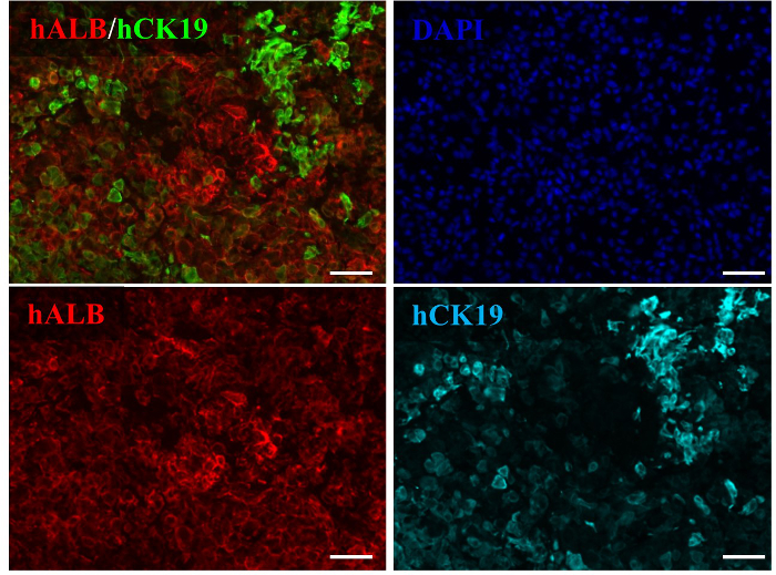 Immunofluorescence microscopy; hALB, hCK19, DAPI staining; cell line marker expression analysis.