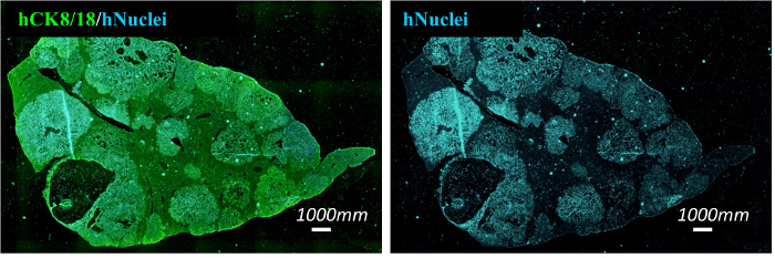 Microscopy image of hCK8/18 and hNuclei in tissue, showing protein expression and cell structure analysis.