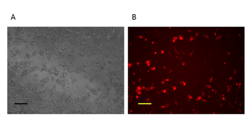 figure-results-2 Microscope images: Phase contrast and fluorescence microscopy of cells for protein localization study.