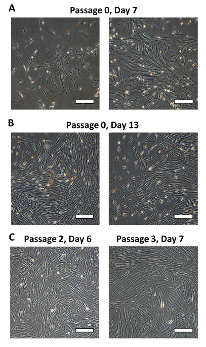 figure-results-3 Cultura de células-tronco, imagem de microscopia, proliferação celular, Passagem 0-3, Dia 6-13, pesquisa em biologia.
