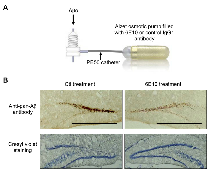 Alzet osmotic pump; diagram & histology of anti-Aβ antibody effect; cresyl violet staining results.