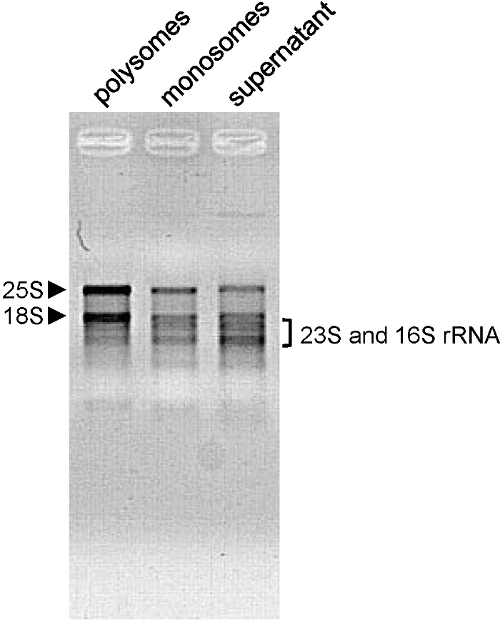 figure-results-2 电泳凝胶结果;rRNA 条带,多聚体、单体核糖体分离,RNA 分析。