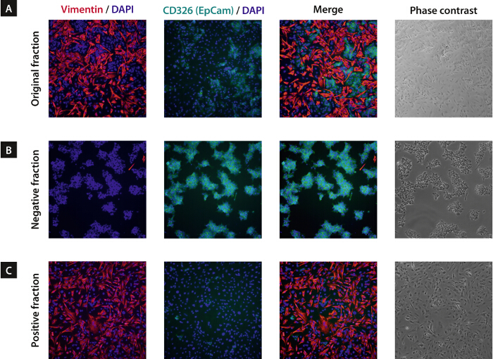 figure-results-4 Immunofluorescence microscopy of cell fractions; Vimentin, CD326 staining; phase contrast analysis.