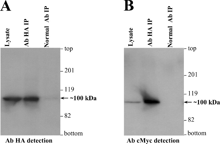 Western blot analysis; protein detection; Ab HA and Ab cMyc; kDa markers; immunoprecipitation results.