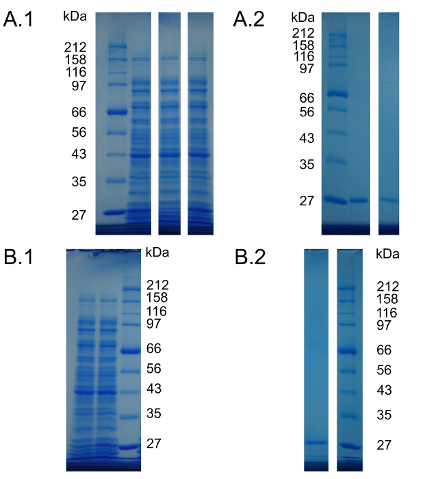 SDS-PAGE gel diagram; protein bands; molecular weight markers; electrophoresis analysis.