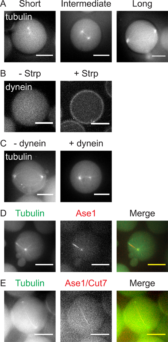 Tubulin and dynein effect on microtubule structure; immunofluorescence microscopy, protein localization.