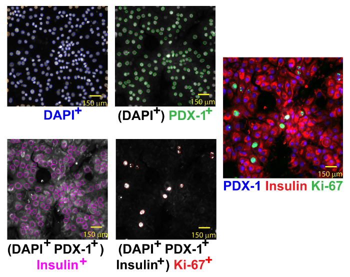 A High-content In Vitro Pancreatic Islet β-cell Replication Discovery ...