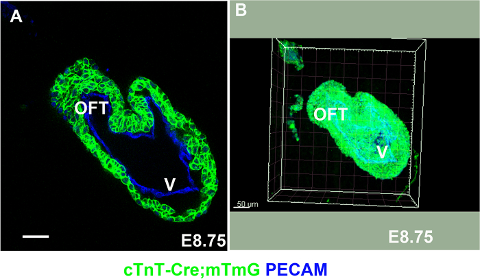 figure-results-1 Heart development E8.75, fluorescence microscopy images showing OFT and V in embryonic mouse tissue.
