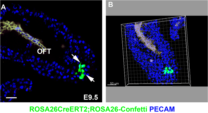 figure-results-2 Embryonic development microscopy; fluorescence image; PECAM marker; ROSA26CreERT2; ROSA26-Confetti.