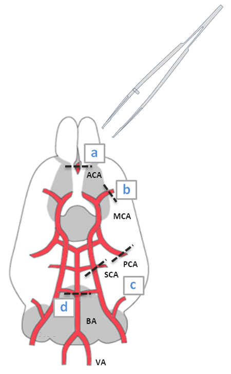 figure-protocol-1 Cerebral artery anatomy diagram with labeled segments and surgical tweezers for vascular study.
