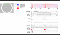figure-results-8 Static equilibrium diagram; graph shows force analysis and displacement trends; structural analysis.