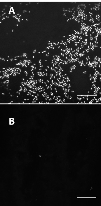 figure-results-6 Fluorescence microscopy image of bacterial cells showing differing densities; cell distribution analysis.