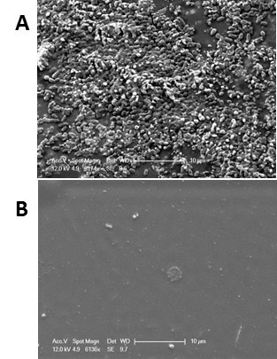figure-results-7 Scanning electron microscopy; A: cell surface, B: post-treatment effect; magnification scale visible.